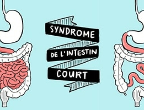 Syndrome de l’intestin court : vidéo